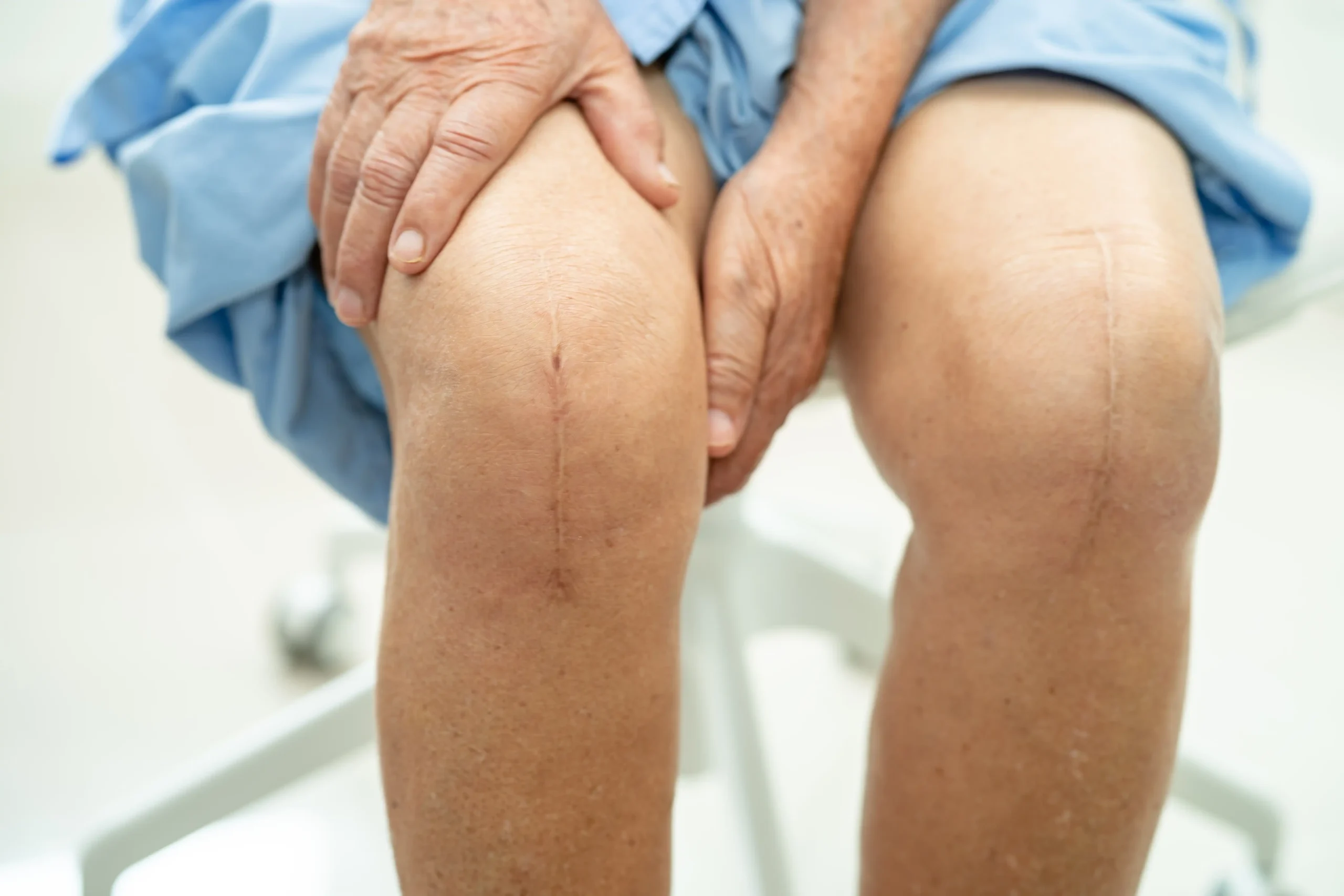 Surgical Knee Pain